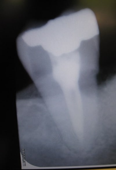Douleur lr006 isgtlv - Eugenol