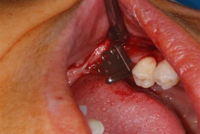 Drapeau easy dufqbd - Eugenol