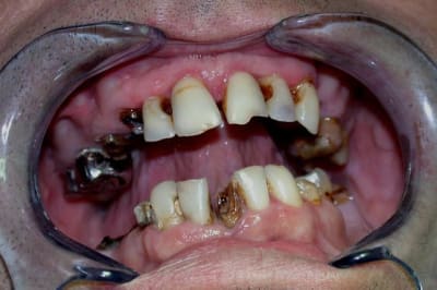 Dum ahrikg - Eugenol