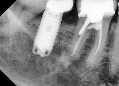 Dxa7xlnnhqgtit0nbuuv - Eugenol