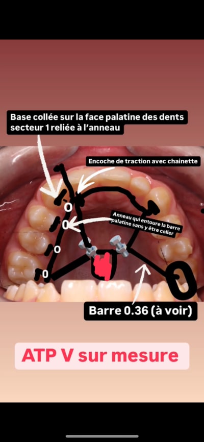 Dy8ztr709q8cri9vrvhw3ts7jeag - Eugenol