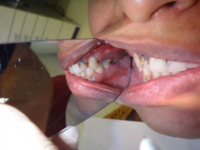 Dzon2mj3nhfhpmb25jpl - Eugenol