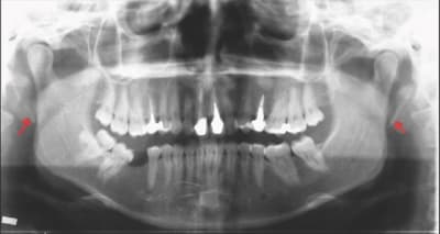 Eagle2 j4hsoq - Eugenol
