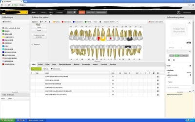 Ecoodentist matbwa - Eugenol