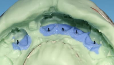 Empreinte cdw7zt - Eugenol