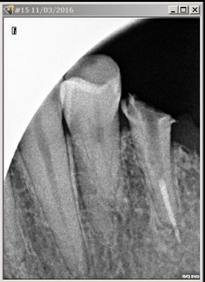 Endo 15 q9g3ql - Eugenol