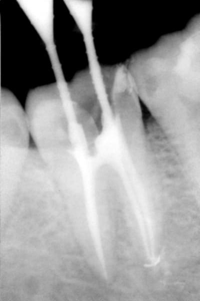 Endo 47 wqd5zg - Eugenol