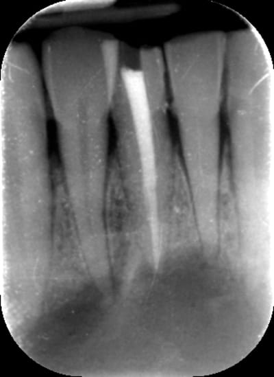 Endo q6sqrh - Eugenol