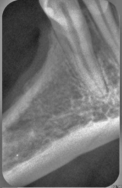 Enigme2 edbyto - Eugenol