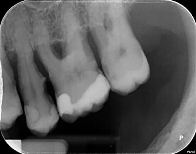 Ers0iqfxbxhhlxhtjkfc - Eugenol