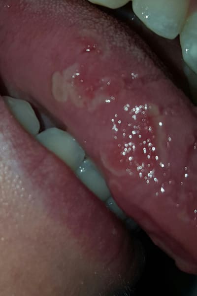 Esojfgmyixwmvmkausi0 - Eugenol