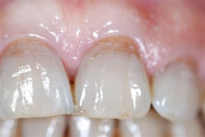 Essai d80 f22zxr - Eugenol