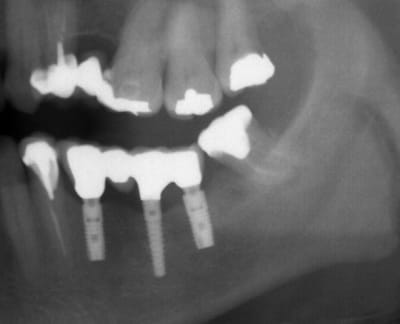 Euroteknika 3mm wdoyej - Eugenol