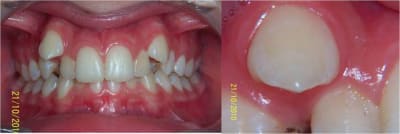 Exemple 1 fgu3od - Eugenol
