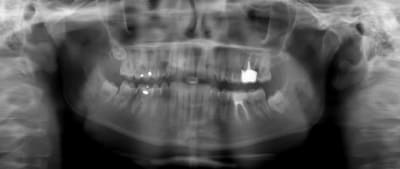 Exemple pano 2 nvjrd6 - Eugenol