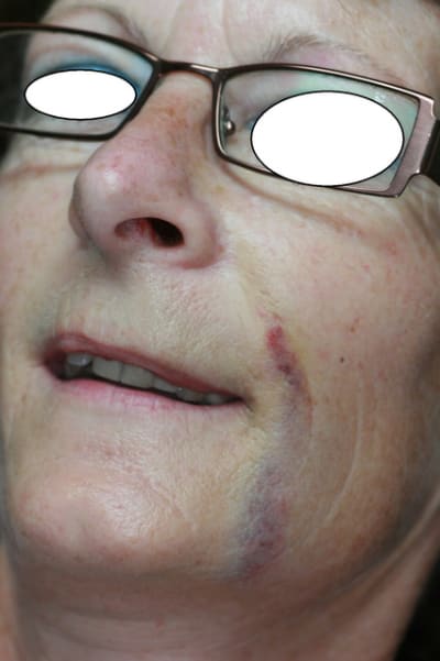 Face 1 dcjjsa - Eugenol