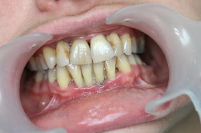 Face qj0hue - Eugenol