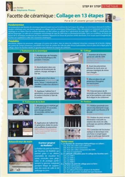 Facette collage lasserre zdat7p - Eugenol