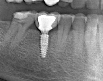 Fanfanlatulipe yqwldo - Eugenol