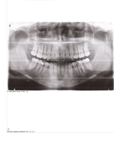 Fcddigfrt9mf3alxsaan - Eugenol