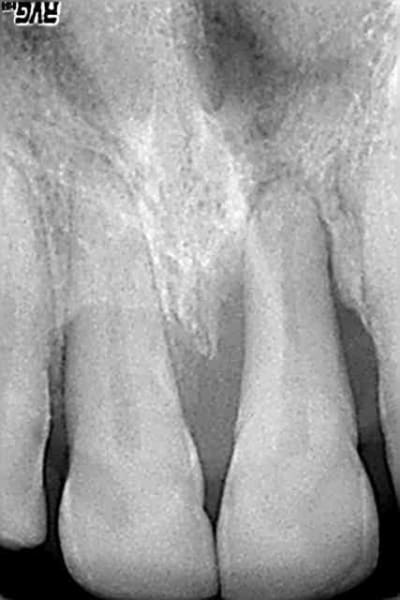 Fev 08 da7anw - Eugenol