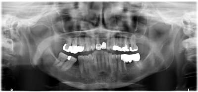 Fgglkexrvtimo7qlildb - Eugenol