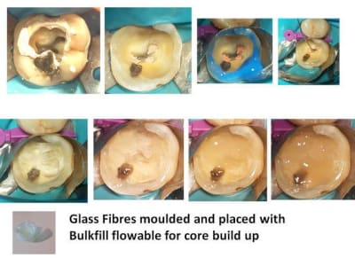 Fibers molar qwtsgs - Eugenol