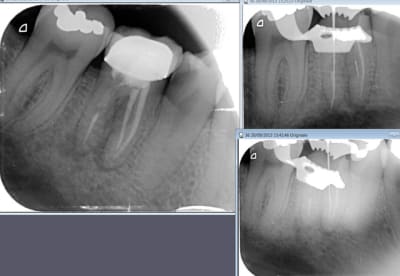 Fibr  vk3mzr - Eugenol