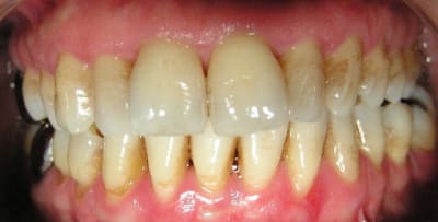 Fin tr1 pr73jb - Eugenol