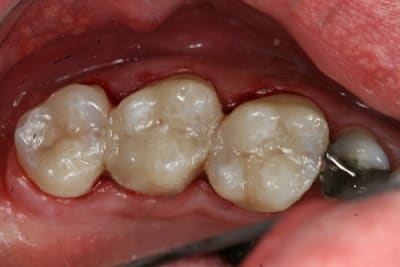 Final qz4ftj - Eugenol