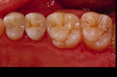 Final xwkdpb - Eugenol