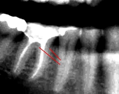 Fiss rxc8ne - Eugenol