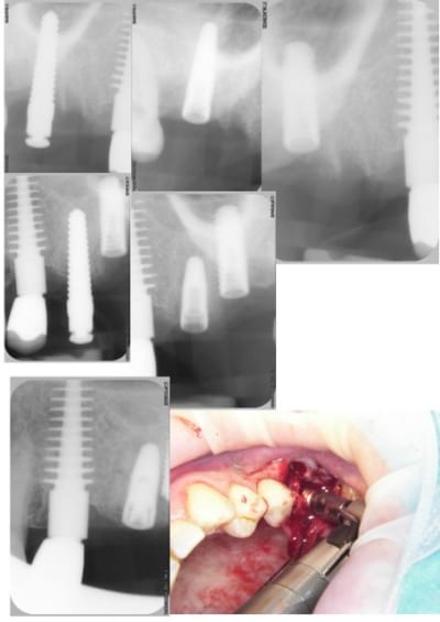 Fojer xjtk2e - Eugenol
