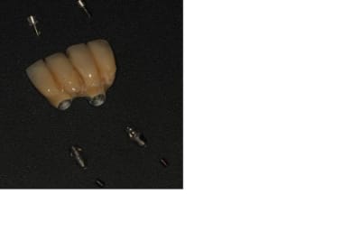Fracture uni20 002 brvfzc - Eugenol