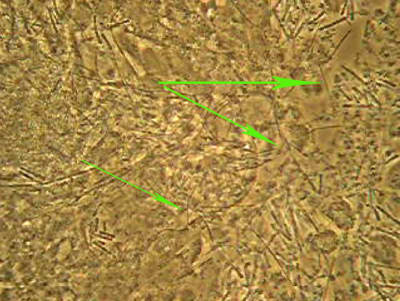 Fusobacterium liunss - Eugenol