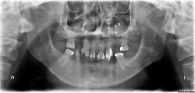 G1 qfp0tz - Eugenol