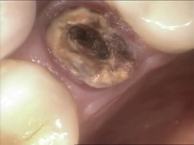 Gar2 tadsna - Eugenol