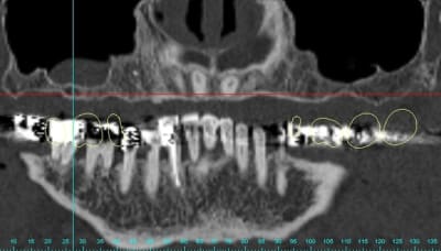 Gart panoramic1 ssmlda - Eugenol
