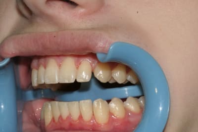 Gauche1 ozrdpo - Eugenol