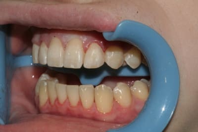 Gauche2 elav3s - Eugenol