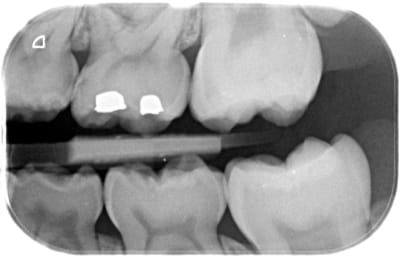 Gauche ph2mcp - Eugenol