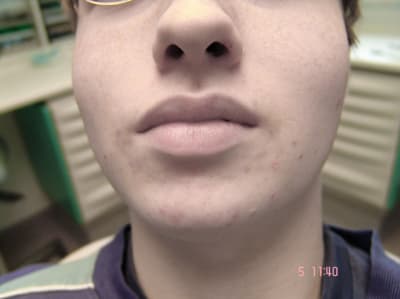 Genb kzx0m9 - Eugenol