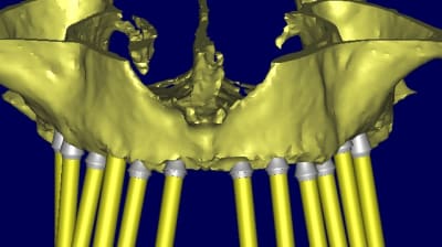Georges 3d3 d3nuro - Eugenol