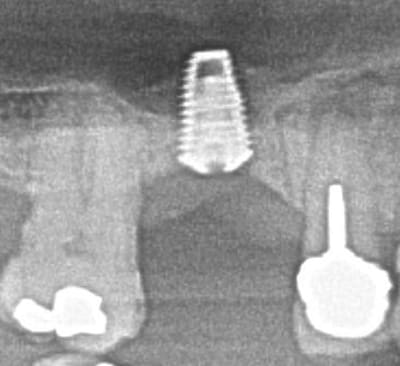 Gregoire2 xlr3n7 - Eugenol