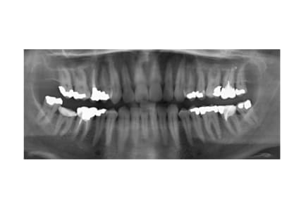 Gtvdvvcs4uuljbxuuz9l - Eugenol
