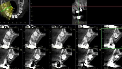 Guillaumin mondelange dentiste 3 jrfabr - Eugenol