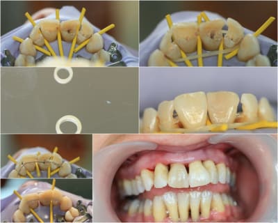 Haut njjy5t - Eugenol