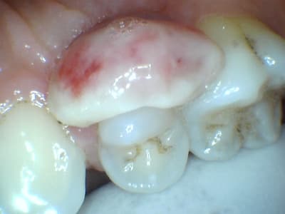 Hhuwhm6a9gerhycytewv - Eugenol