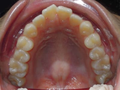 Horizontalflip0 ia5spi - Eugenol