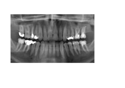 Ij6u9pb3s0sqtldunz0b - Eugenol